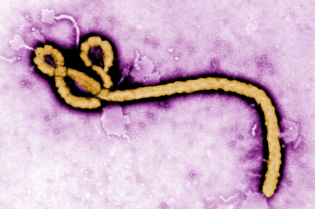 Ebola virus opinion
