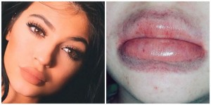 landscape_nrm_1429537367-kylie_jenner_lip_challenge